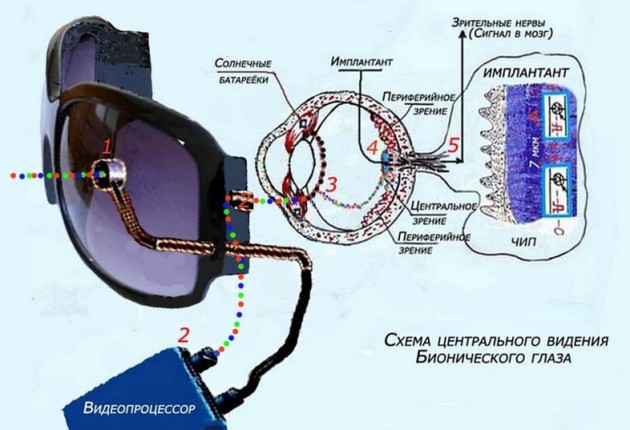 Shema_Bionicheskogo_glasa_v_sonach_zenralnogo_videnia